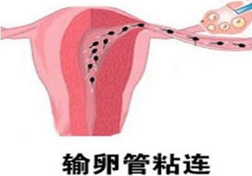 新西兰安满孕妇奶粉怎么样,搞清楚各方面才敢放心喝