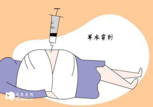 卵巢早衰的症状都有什么，这些卵巢早衰的早期信号女性看仔细了！